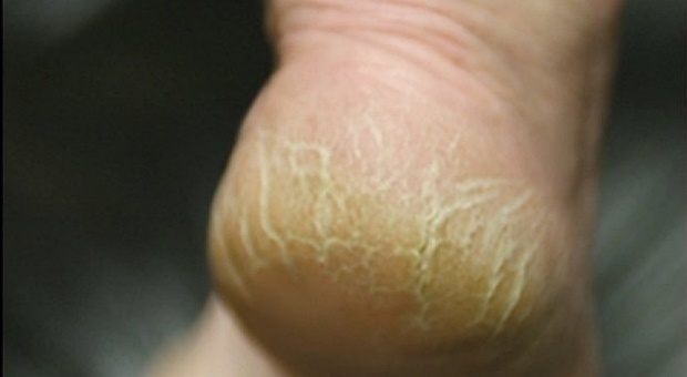 55bcc2b4-8b98-42ef-81e7-67c90a0a0a6c-heeltastic-6-690x480