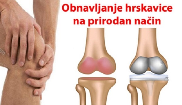 Obnavljanje-hrskavice-na-prirodan-nacin